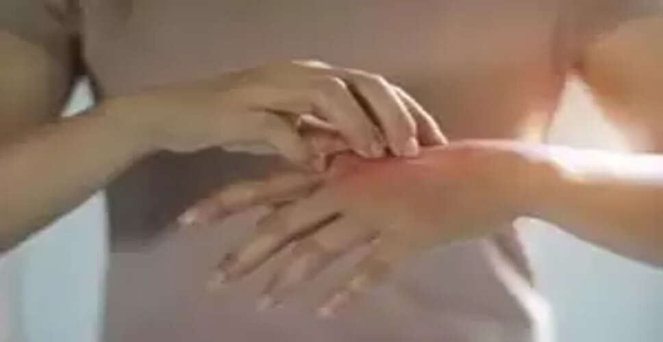 Ho Chi Minh City Faces Alarming Rise in Hand-Foot-Mouth Disease Cases