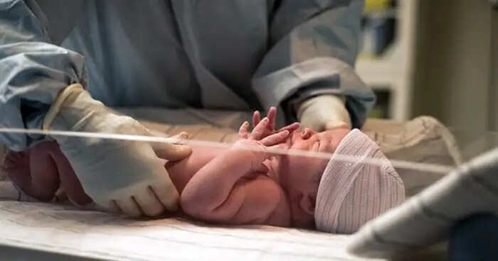 Rare Case of Baby Born with Three Genitals in Iraq