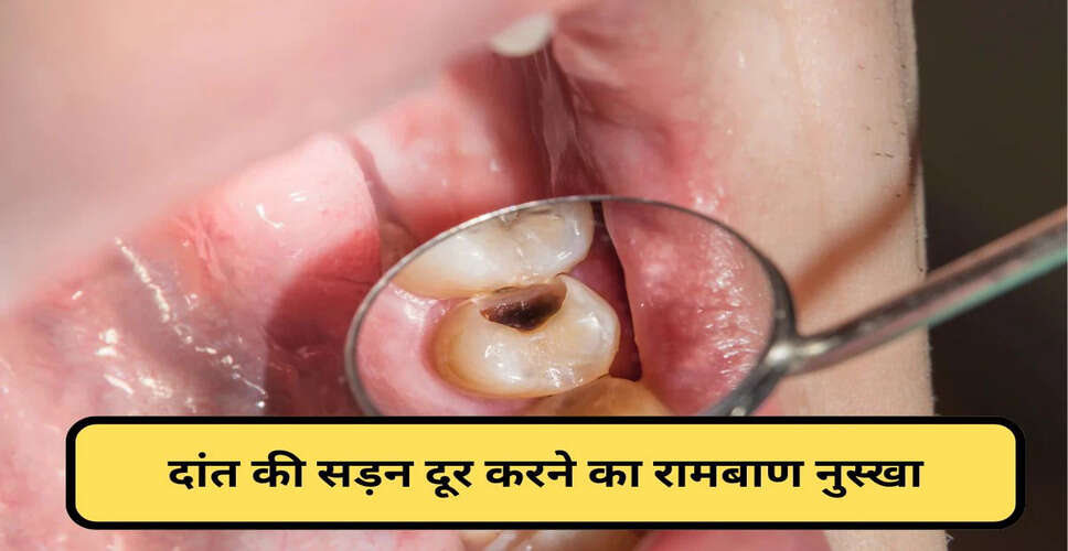 Effective Home Remedies for Tooth Cavities