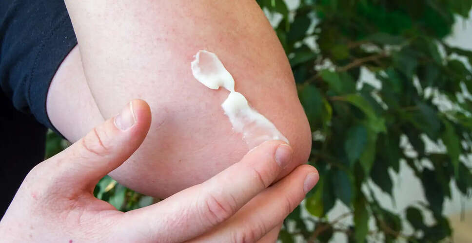 Understanding the Safety of Mosquito Repellent Creams for Your Skin