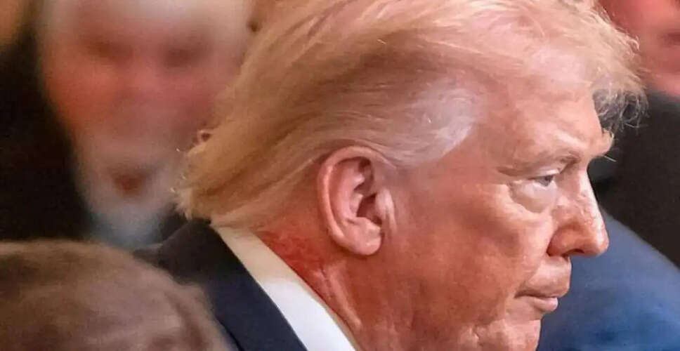 White House Addresses President Trump's Neck Rash Speculation