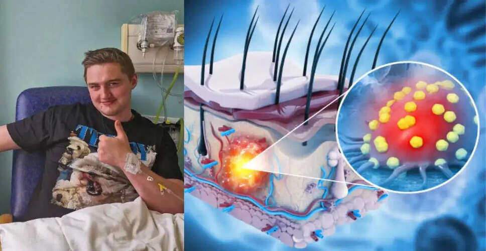 Finnian Garbutt Faces Final Stages of Cancer Battle, Urges Support for Family