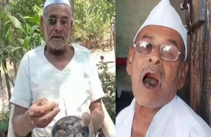 Elderly Man's Unusual Habit of Eating Stones for 31 Years