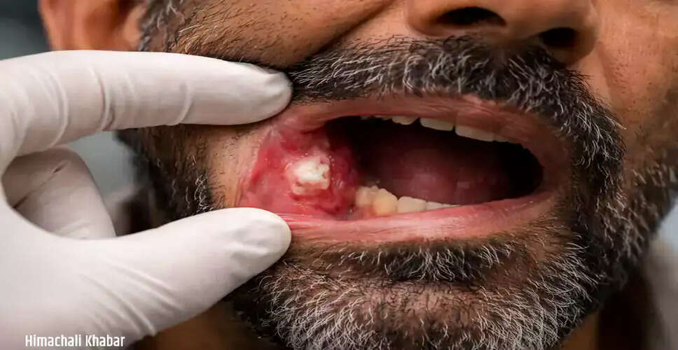 Understanding the Signs of Oral Cancer: Early Detection is Key