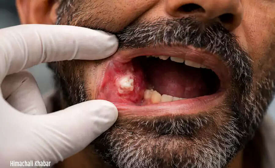 Understanding the Signs of Oral Cancer: Early Detection is Key