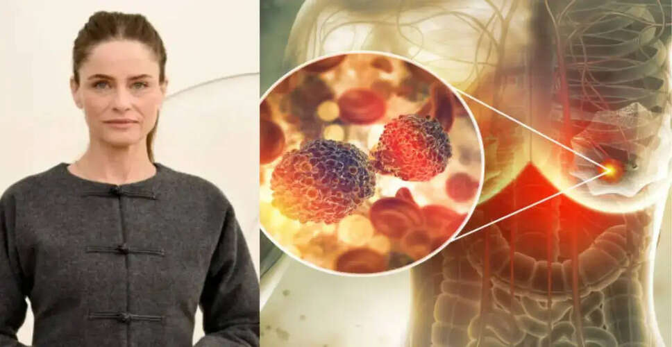 Amanda Peet's Breast Cancer Diagnosis Highlights Importance of Early Screening