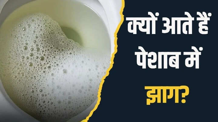 Understanding Foamy Urine: Causes and Remedies