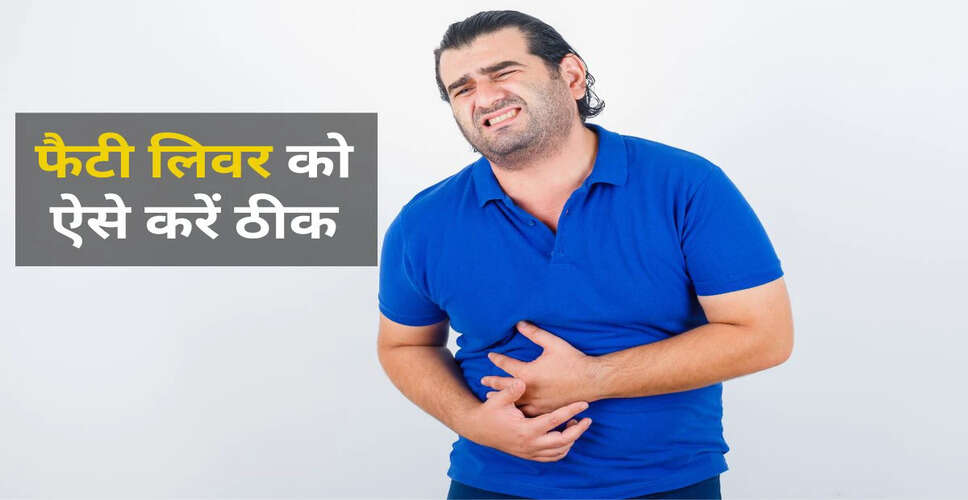 Effective Home Remedies for Fatty Liver Management