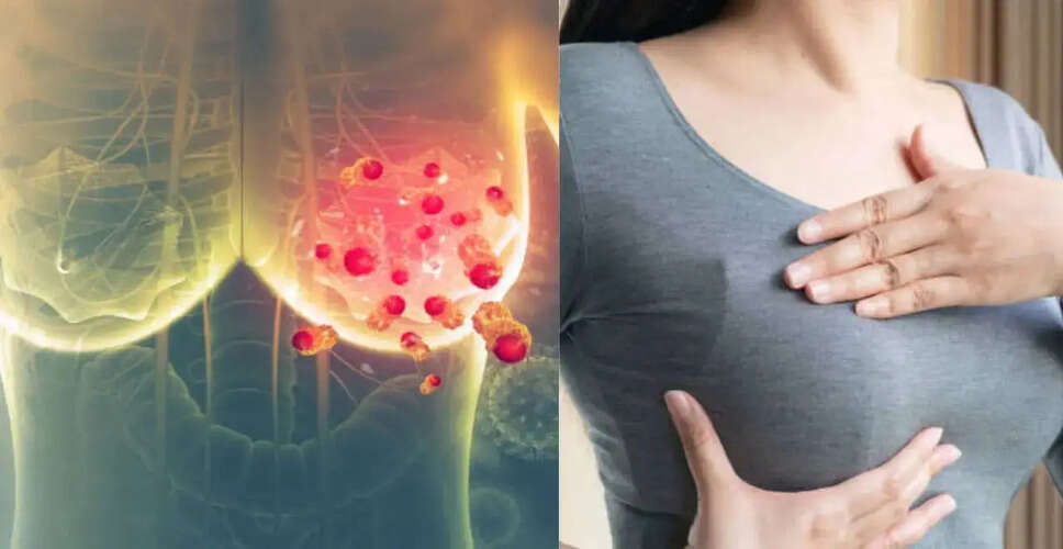 Rising Breast Cancer Rates in India: A Growing Health Concern