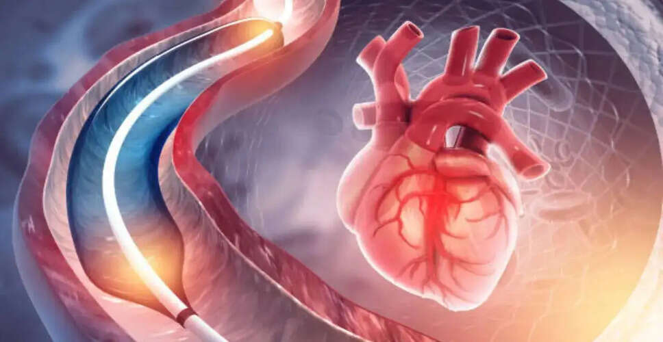 Understanding Angiography: Debunking Myths and Recognizing Heart Health