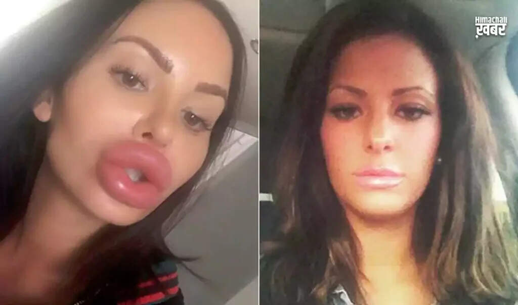 ऑस्ट्रेलिया की महिला की सर्जरी की अनोखी कहानी