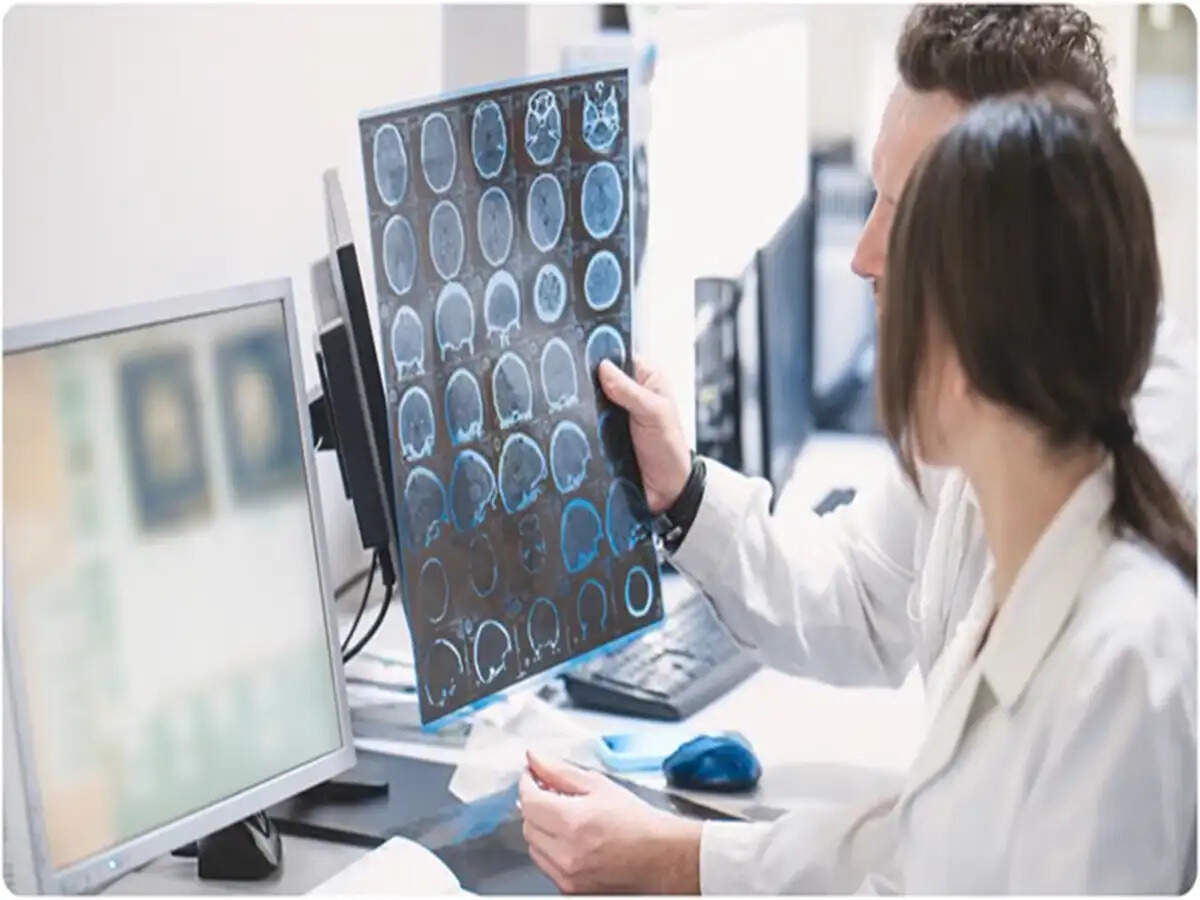 Understanding Stroke: Symptoms, Risks, and Urgent Treatment