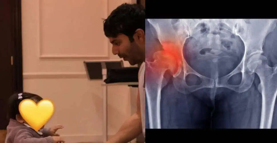 Understanding Developmental Dysplasia of the Hip: Insights from Varun Dhawan's Experience