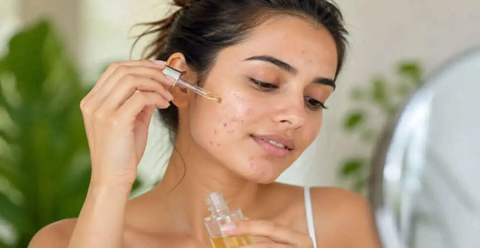 Understanding Face Oils: Can They Help Acne-Prone Skin?