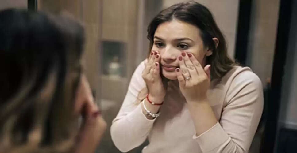 DIY Body Lotion Recipe for Winter Skin Care