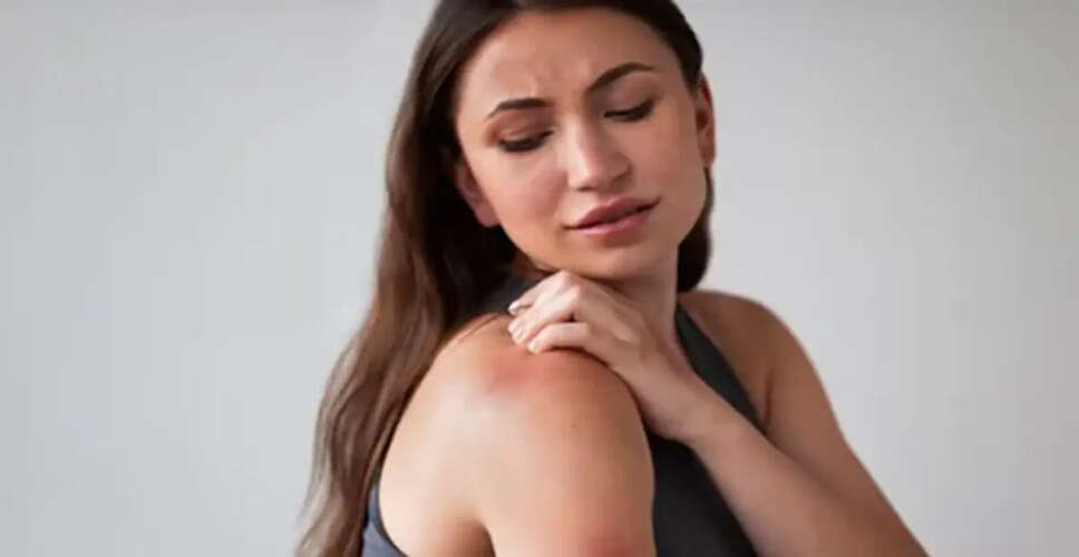 Essential Summer Skincare Tips to Prevent Infections
