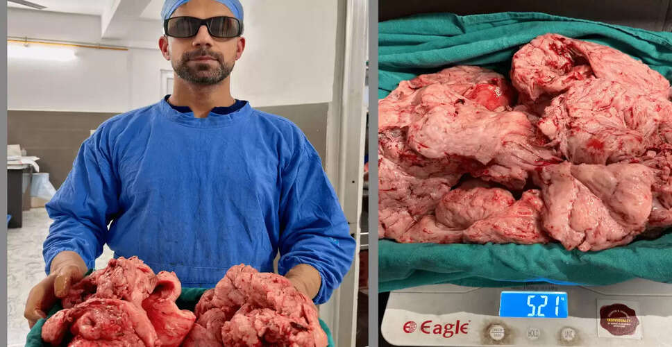 Groundbreaking Laparoscopic Surgery Sets New Record in Mandi