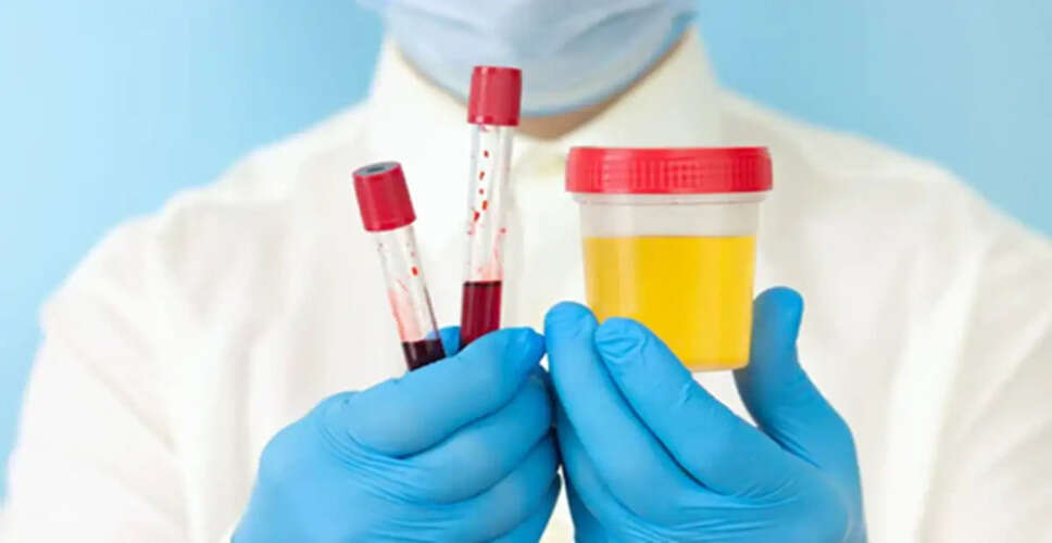 The Importance of Urine Tests in Health Diagnostics