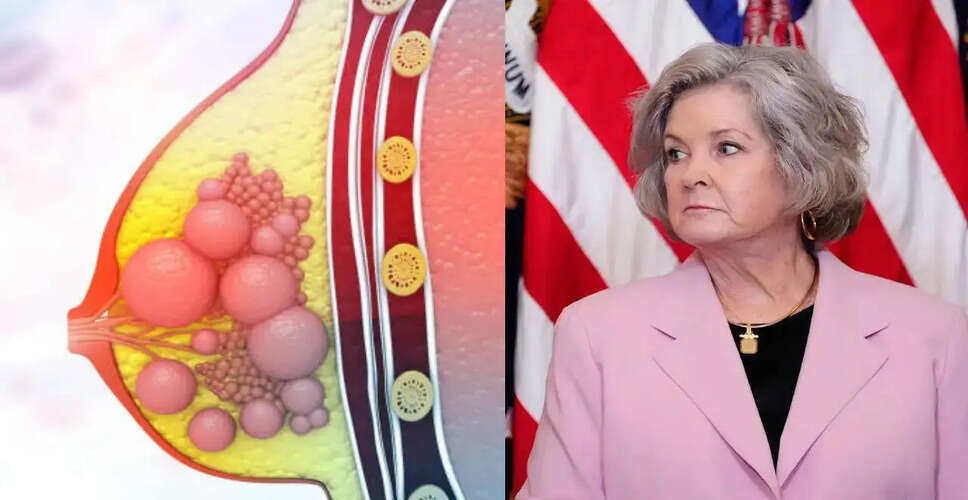 Breast Cancer Awareness: The Importance of Early Detection and Screening