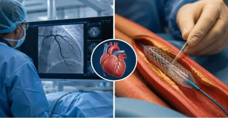 Understanding the Distinction Between Angiography and Angioplasty for Heart Health