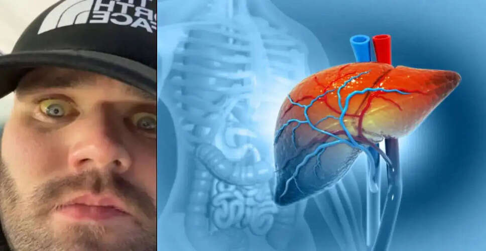 Young Man Overcomes Severe Alcohol Addiction and Liver Damage