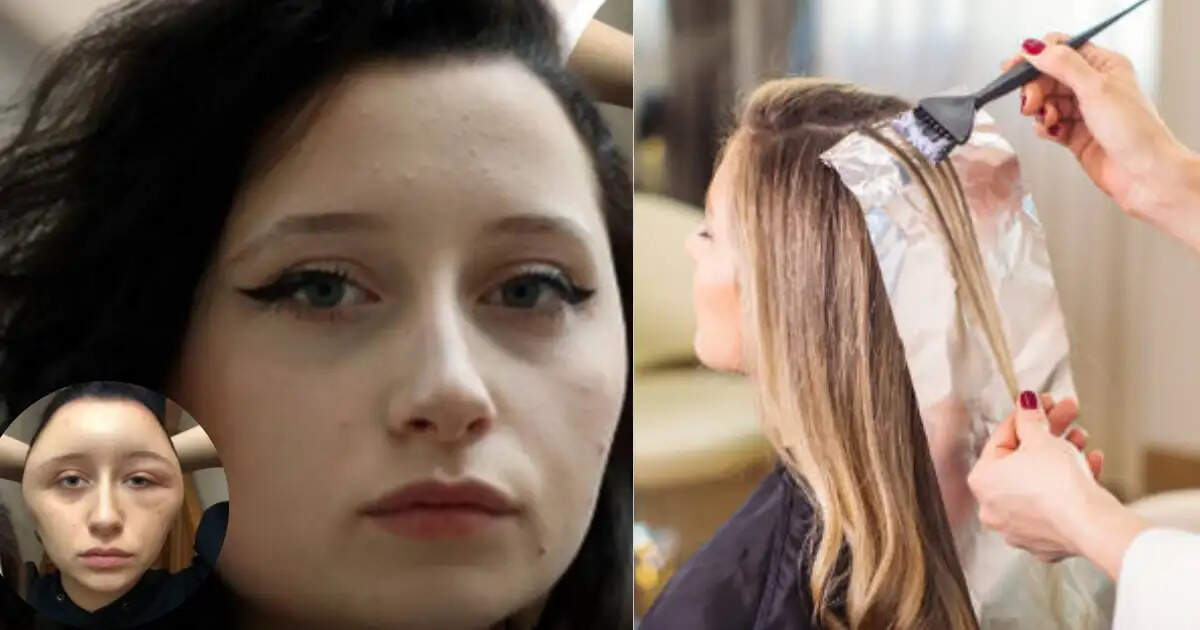 Teen Hospitalized After Hair Dye Reaction: A Cautionary Tale