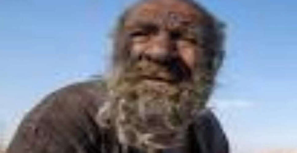 The Extraordinary Life of the World's Dirtiest Man: A Tale of Hygiene and Health