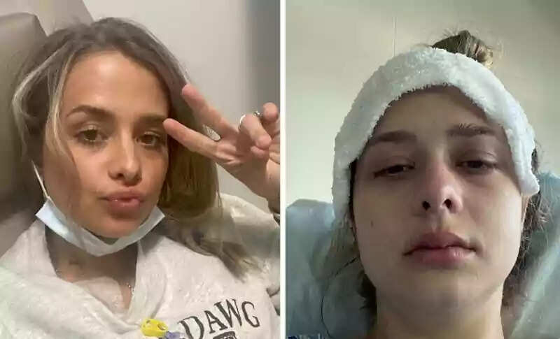 Excessive Burping: A Warning Sign of Colon Cancer