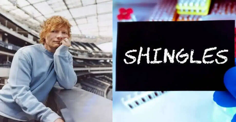 Ed Sheeran's Battle with Shingles: A Cautionary Tale for All