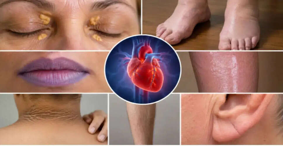 Uncovering Heart Health: Skin Signs You Shouldn't Ignore