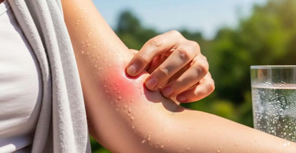 Essential Tips to Combat Summer Skin Itchiness