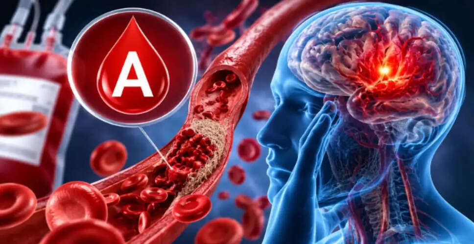 Blood Type A Linked to Increased Early Stroke Risk, Study Reveals