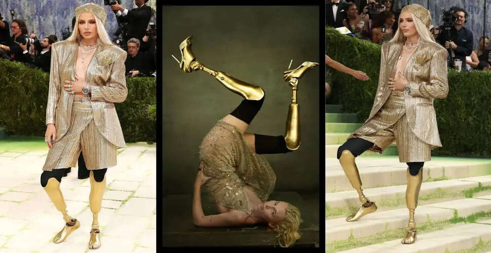 Lauren Wasser: A Symbol of Resilience at the 2026 MET Gala