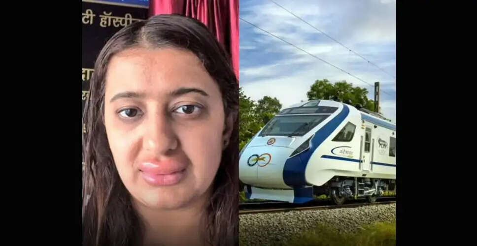 Woman Suffers Severe Allergy After Meal on Vande Bharat Express