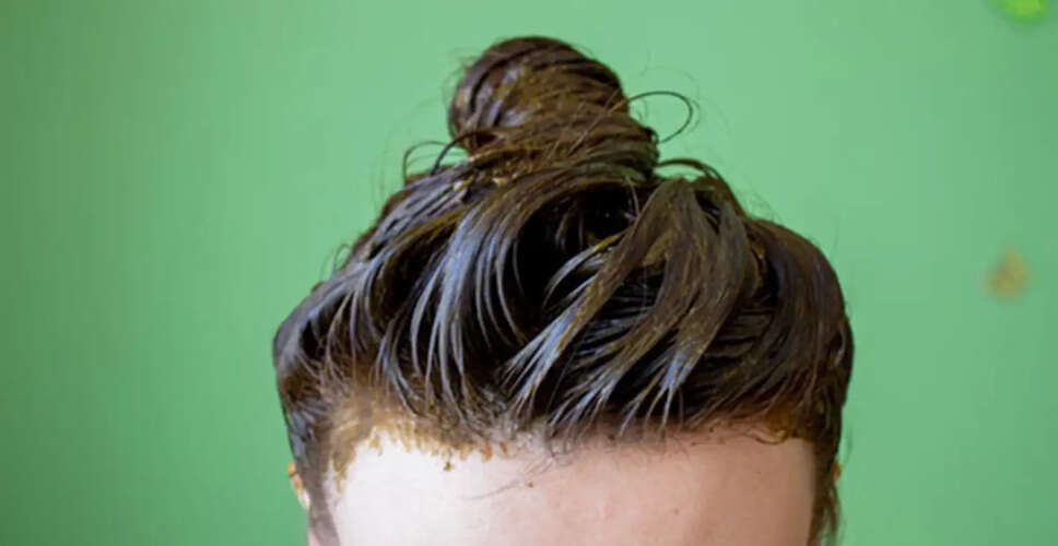 Natural Remedies to Reverse Premature Graying of Hair