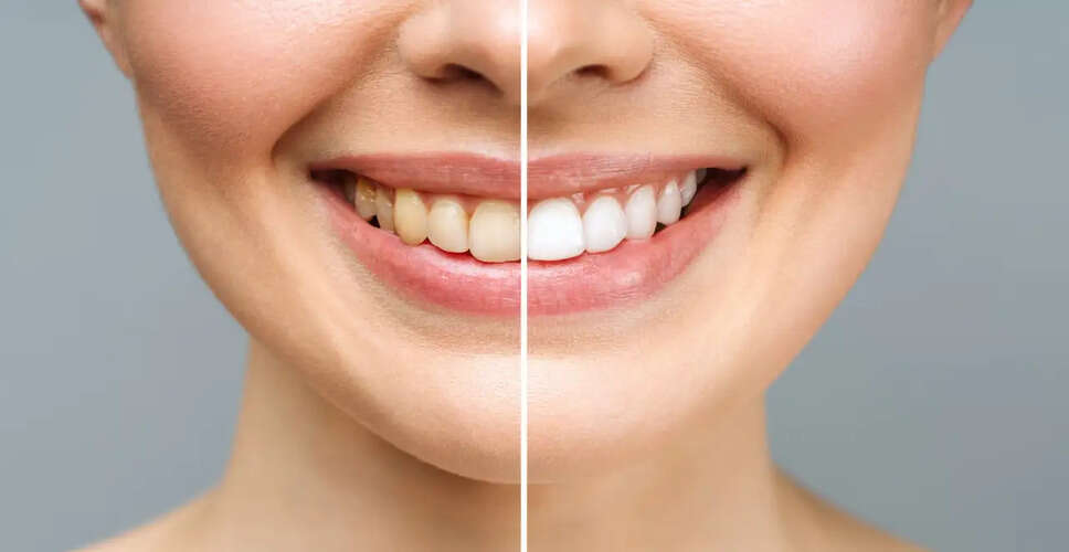 The Truth About Jamun and Teeth Whitening: What You Need to Know