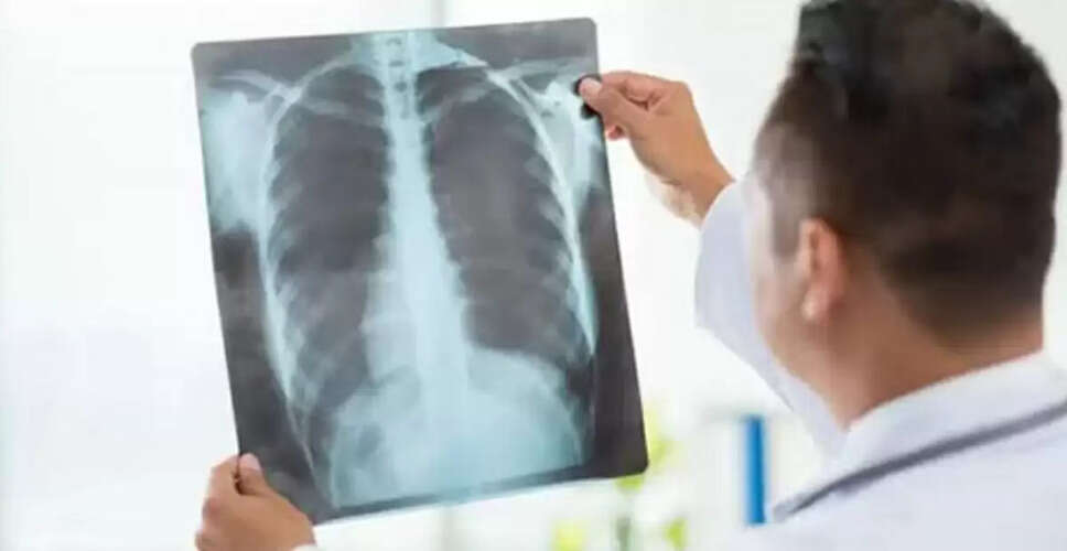 Google Unveils New AI Models to Revolutionize Healthcare Management