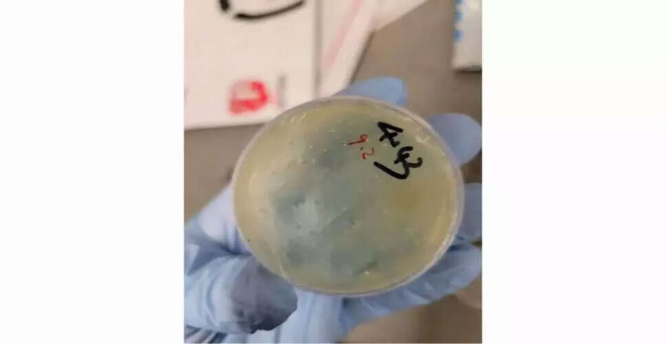 Chinese Researcher Arrested for Smuggling Biological Materials into the US