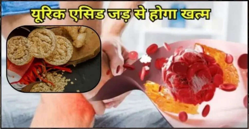 Effective Home Remedies to Reduce Uric Acid Levels Naturally