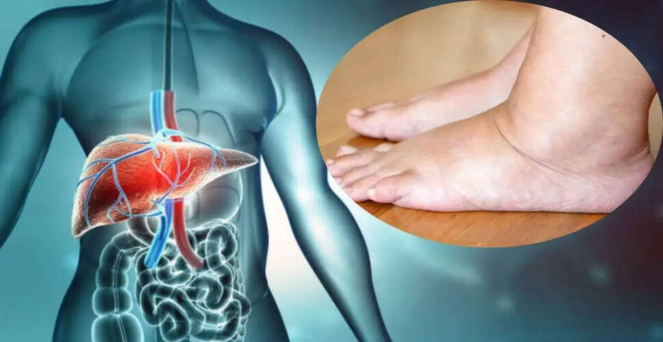 Uncovering Liver Health: How Your Feet Can Signal Problems