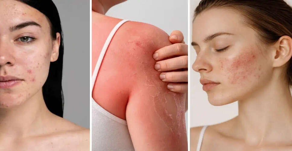 Essential Tips for Healthy Skin During Summer Heat