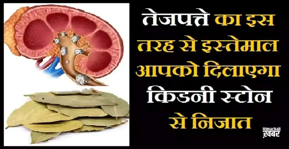 The Health Benefits of Bay Leaves You Should Know