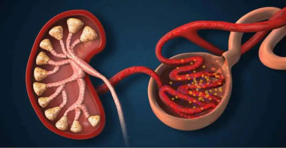 Understanding Glomerulonephritis: A Silent Threat to Kidney Health