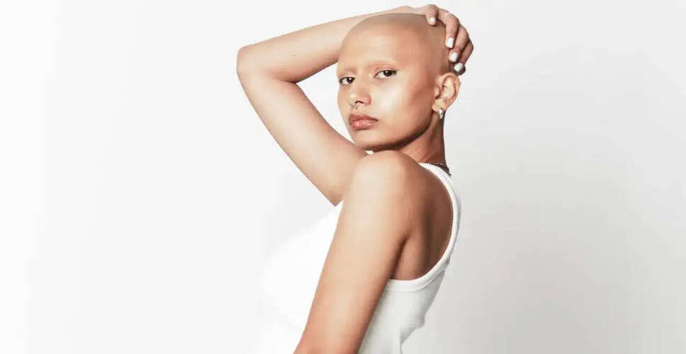 Rashi Singh's Journey: From Hair Loss to Empowerment and Modelling Success