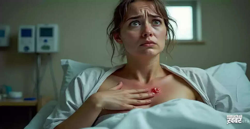 The Dangers of Popping Pimples: A Cautionary Tale from New York