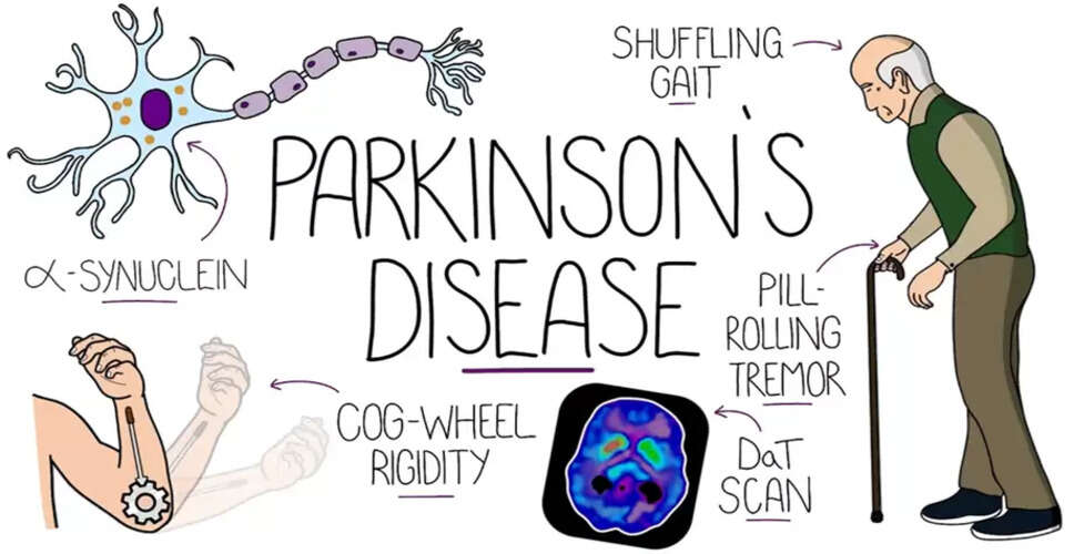Understanding Parkinson's Disease: Prevention Strategies and Insights