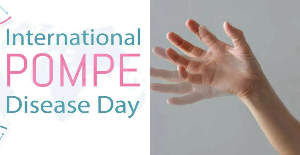 Understanding Pompe Disease: Causes, Symptoms, and Treatment Options