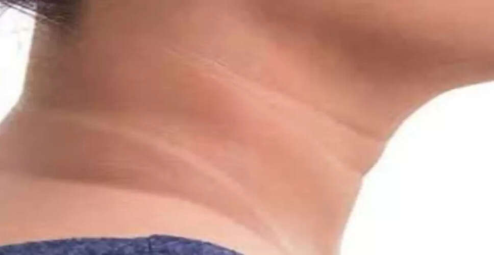 Achieve a Radiant Neck: Effective Home Remedies for Skin Care