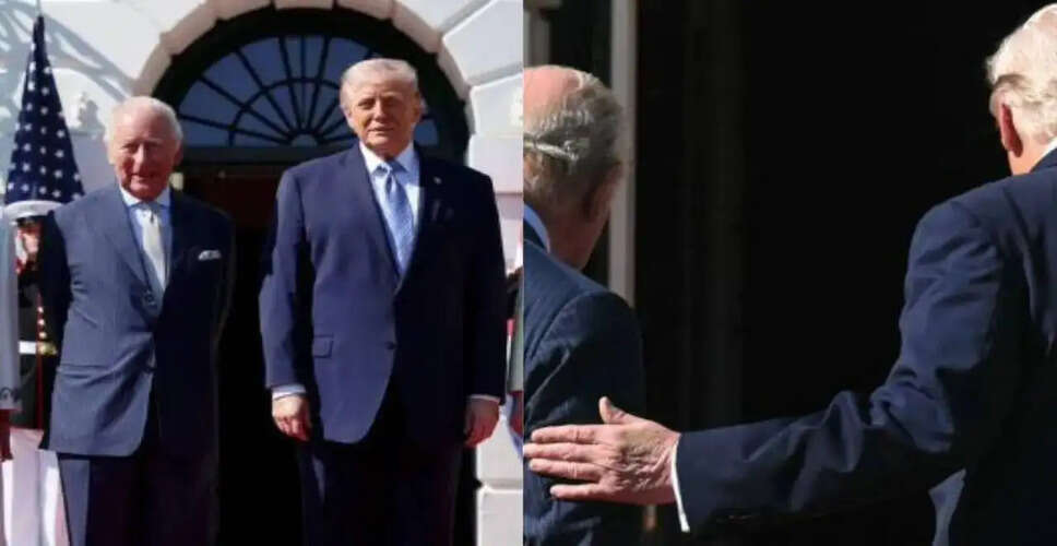 Concerns Arise Over Trump's Hand Discoloration During Royal Visit