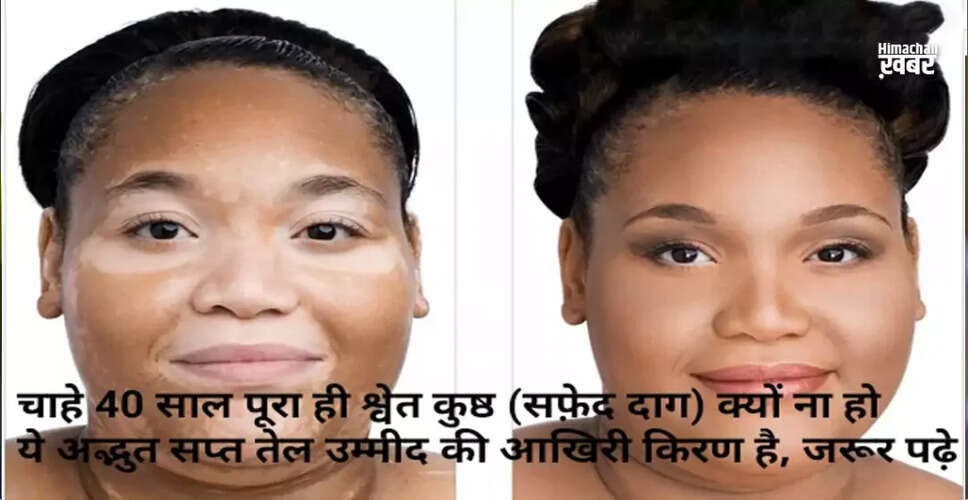 Effective Use of Seven Oils for Skin Conditions: A Traditional Approach